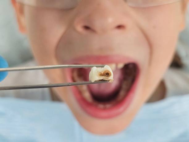 Best Walk-In Emergency Dental Services in Lancaster, WI